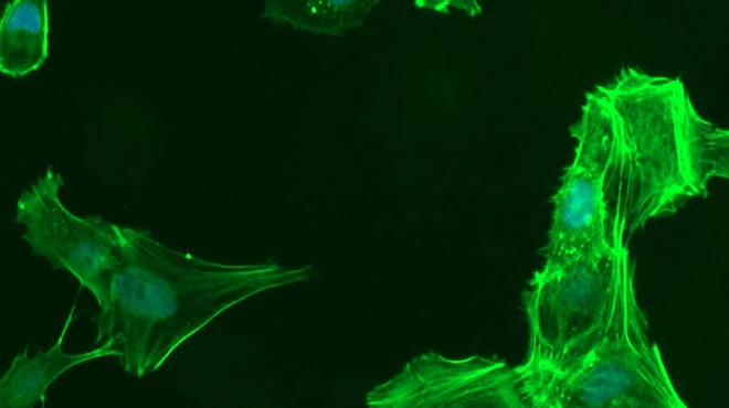 Trabecular meshwork cells