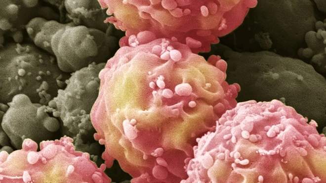 Umbilical cords yield