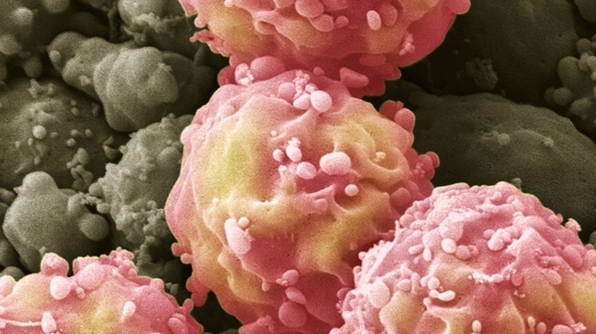 Umbilical cords yield