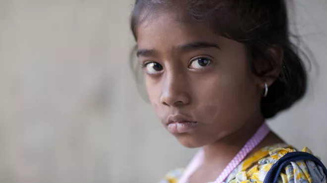 Girl with leprosy