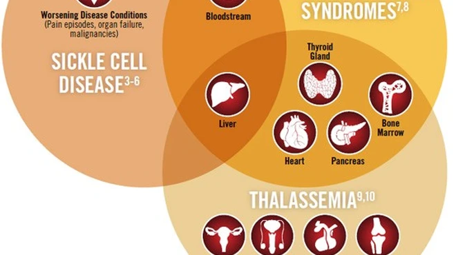 Chronic Iron Overload Complications Infographic