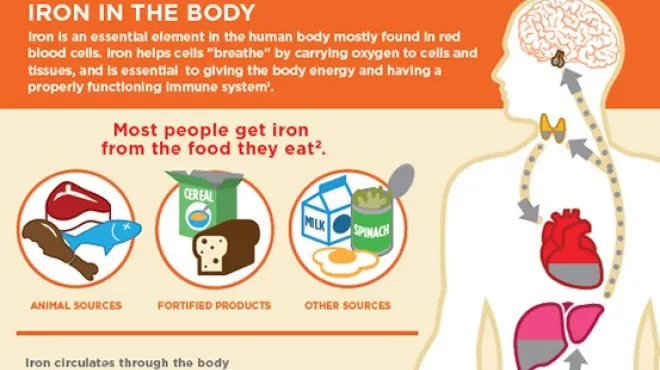 Chronic Iron Overload Infographic