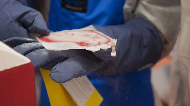 Patient's frozen T-Cells