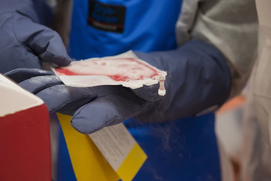 Patient's frozen T-Cells