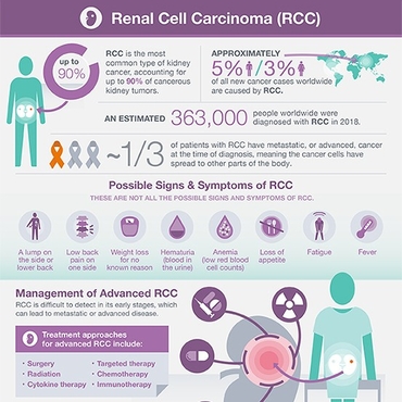 RCC Infographic