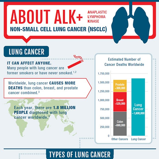 ALK+ NSCLC Disease State Infographic