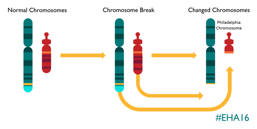 Myeloid leukemia is evolving