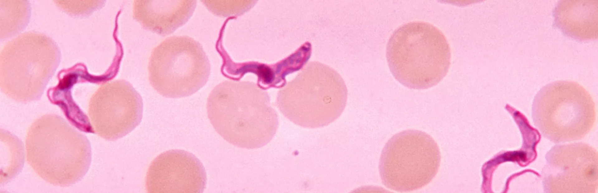 Blood smear from patient with African Sleeping sickness (Centers for Disease Control and Prevention)