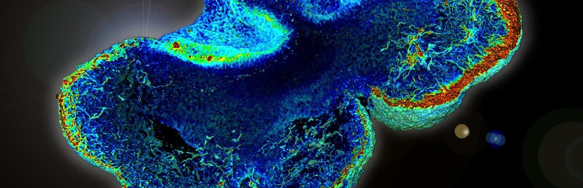 Building brain organoids to shed light on disease