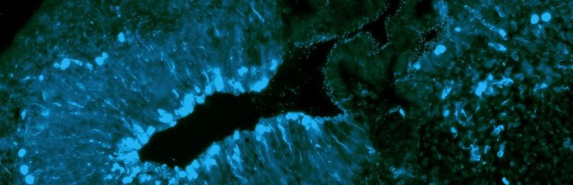 Close-up of the brain