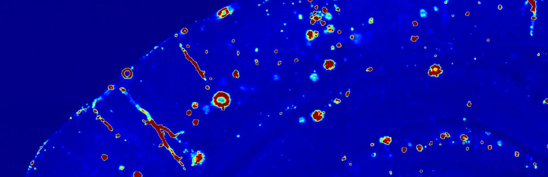 Getting down to the roots of Alzheimer’s disease