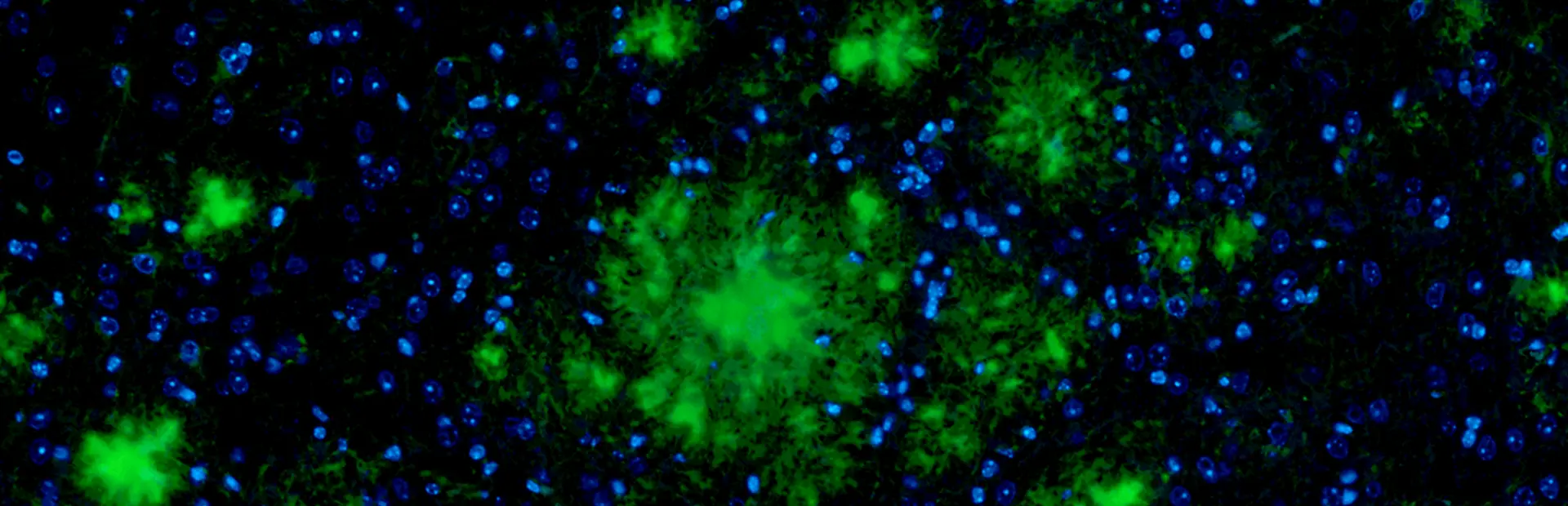 Amyloid plaques (green) in brain tissue.