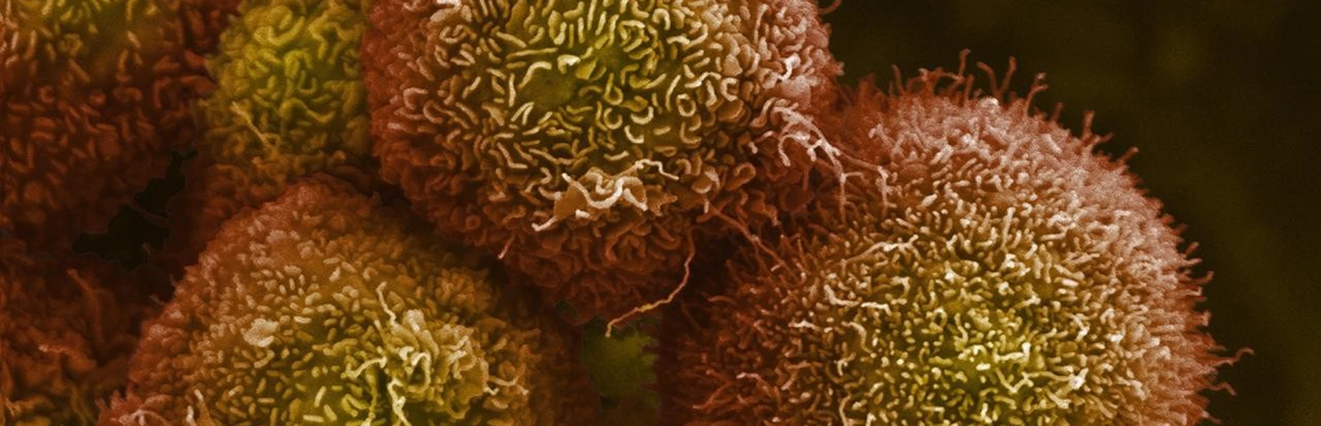 Intractable tumor cells crippled