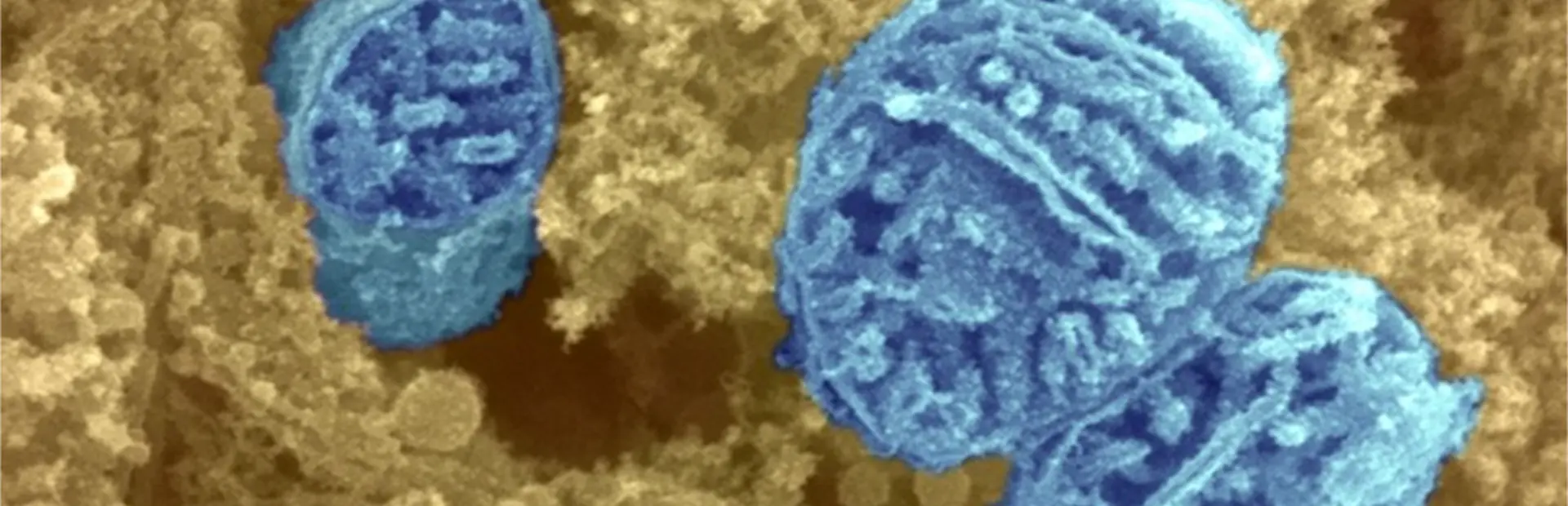 Stopping free radicals at their source