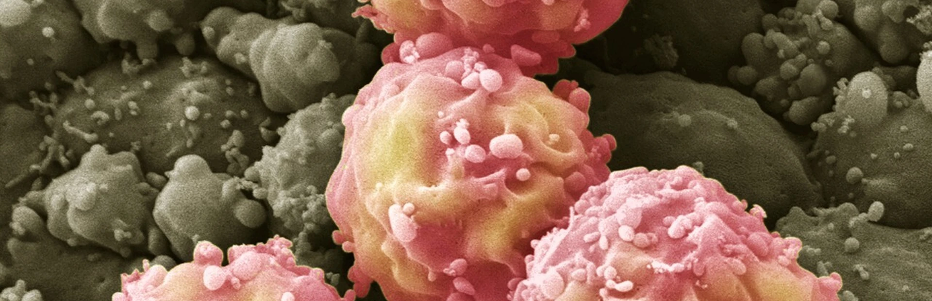 Umbilical cords yield