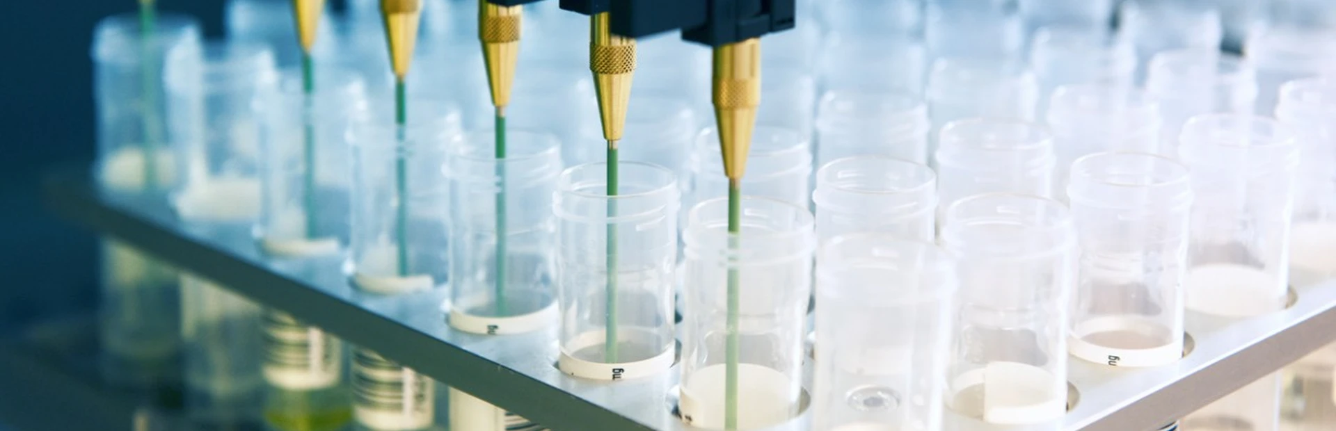 Vice President and Head of CAR-T US shares her story for “Women in Science