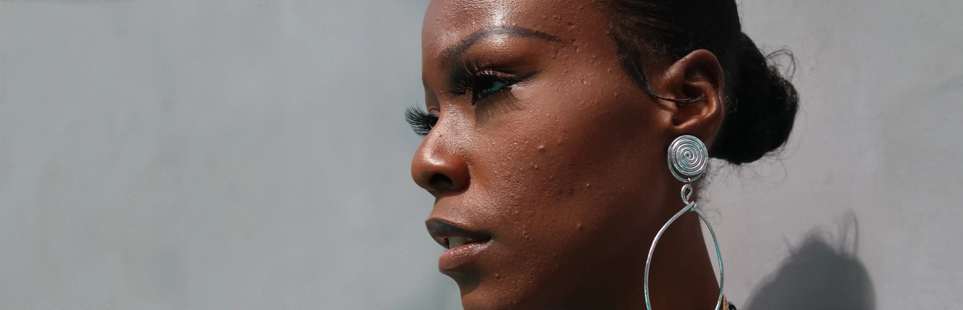 A portrait of Jasmine, an hidradenitis suppurativa (HS) advocate, journalist and filmmaker