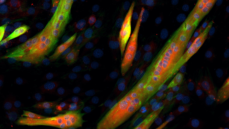 Muscle Fiber