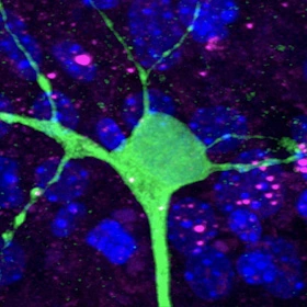 mutant-protein-spreads-through-a-neural-circuit-in-huntingtons-disease-3d-model