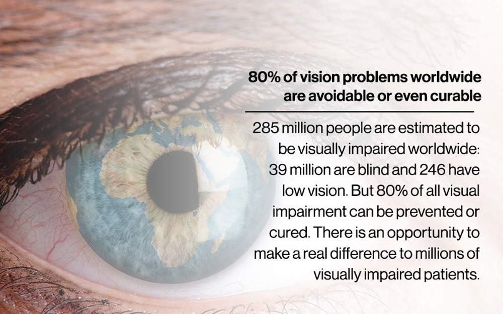 Eye fact 7