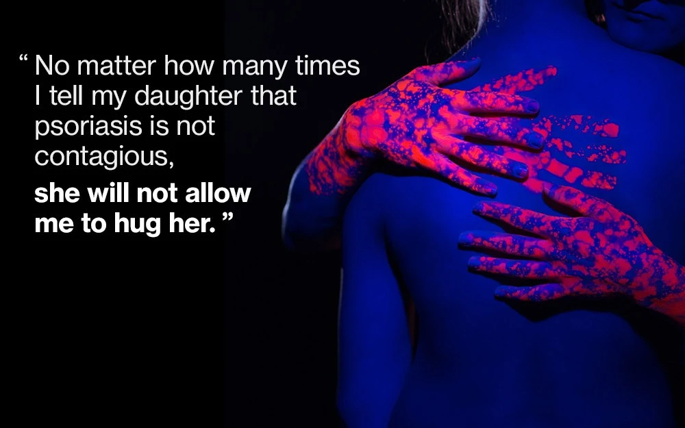 Artistic rendering of a psoriasis patient receiving an embrace