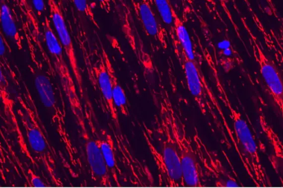 Skeletal Mitochondria