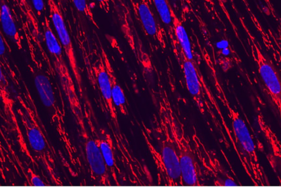 Skeletal Mitochondria