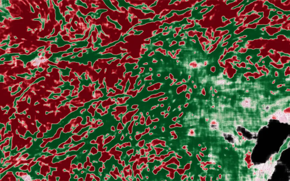AI image overlay of pathology image