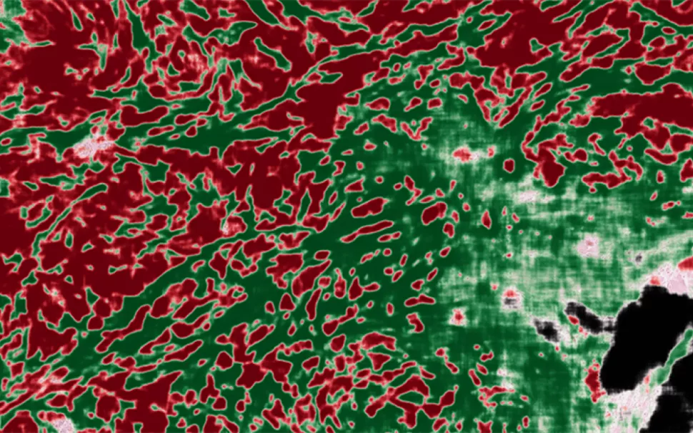 AI image overlay of pathology image