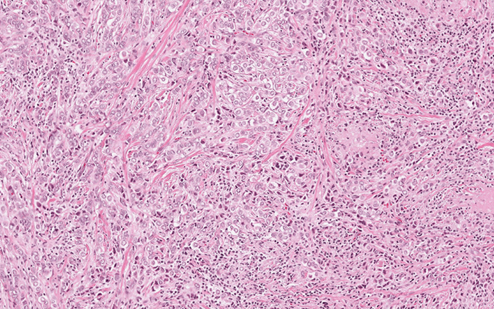 Image of pathology slide