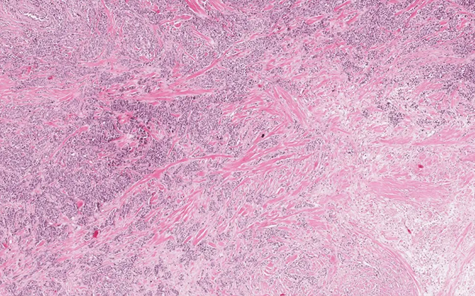 Image of pathology slide