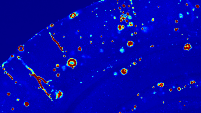 Getting down to the roots of Alzheimer’s disease