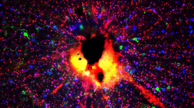 Retinal ganglion cells