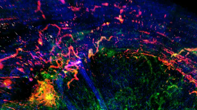 A look inside a tumor