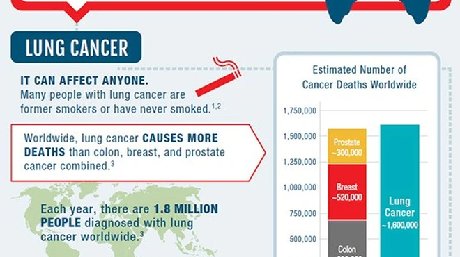 ALK+ NSCLC Disease State Infographic