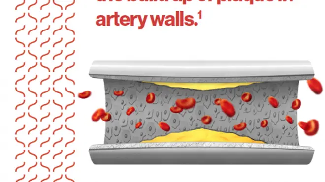 Measuring levels of inflammation has been shown to accurately identify people most at risk of having a cardiovascular (CV) event.