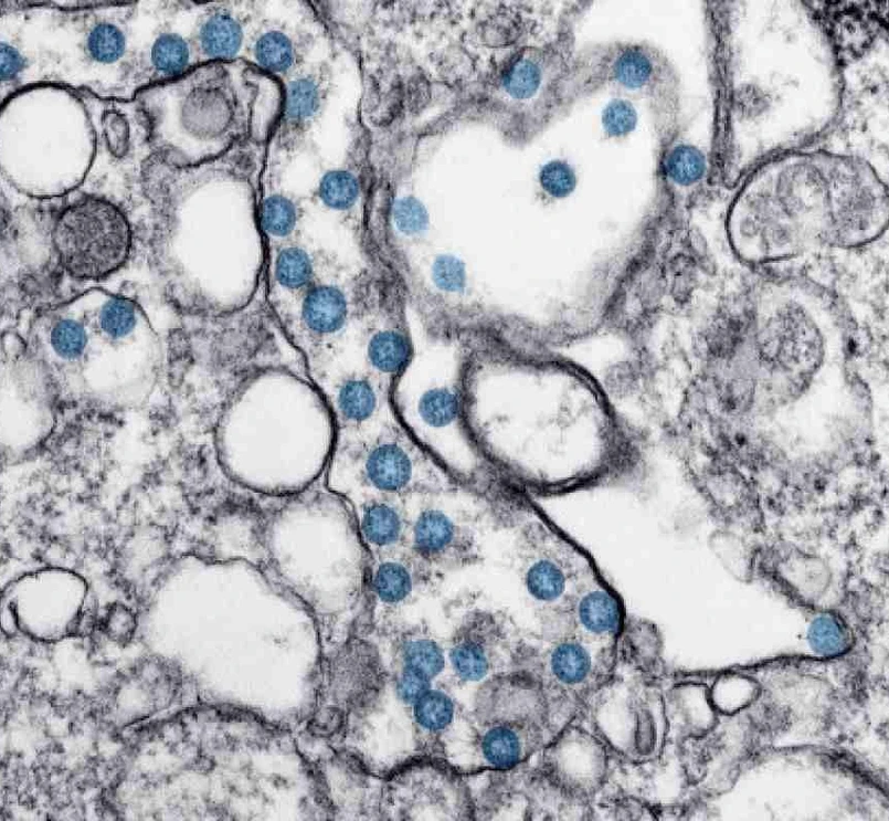 coronavirus-microscope-image