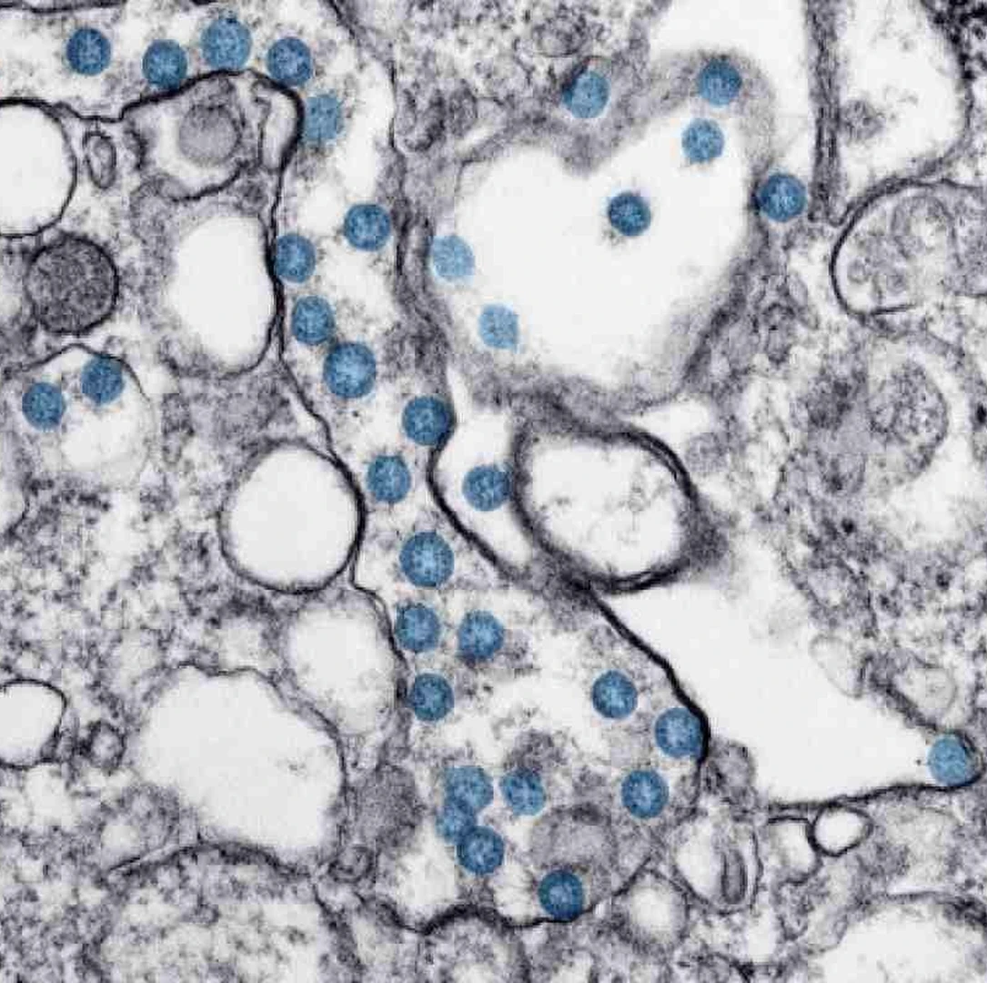 coronavirus-microscope-image