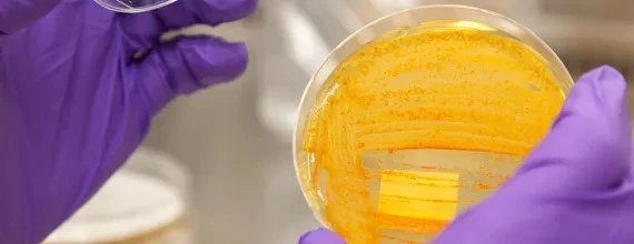 Антимікробна резистентність (AMR)