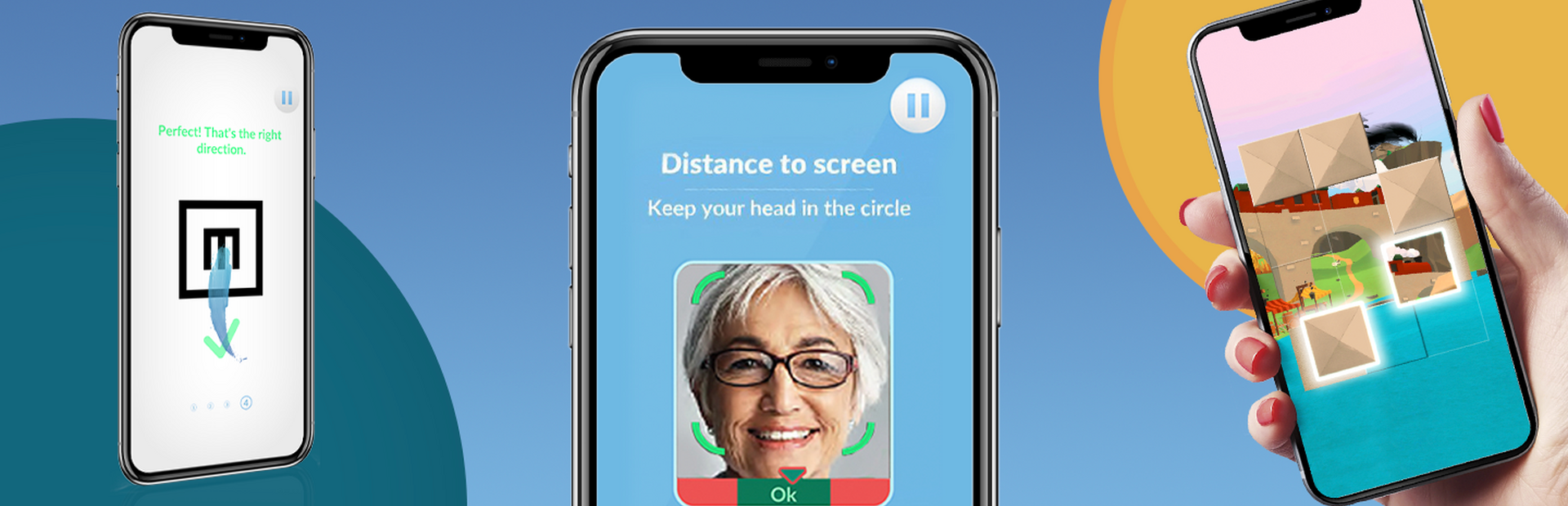Mobile phones display app’s tests and games for patients and ophthalmologists to help monitor vision