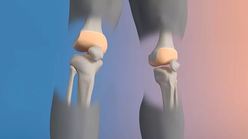 Legs with bones
