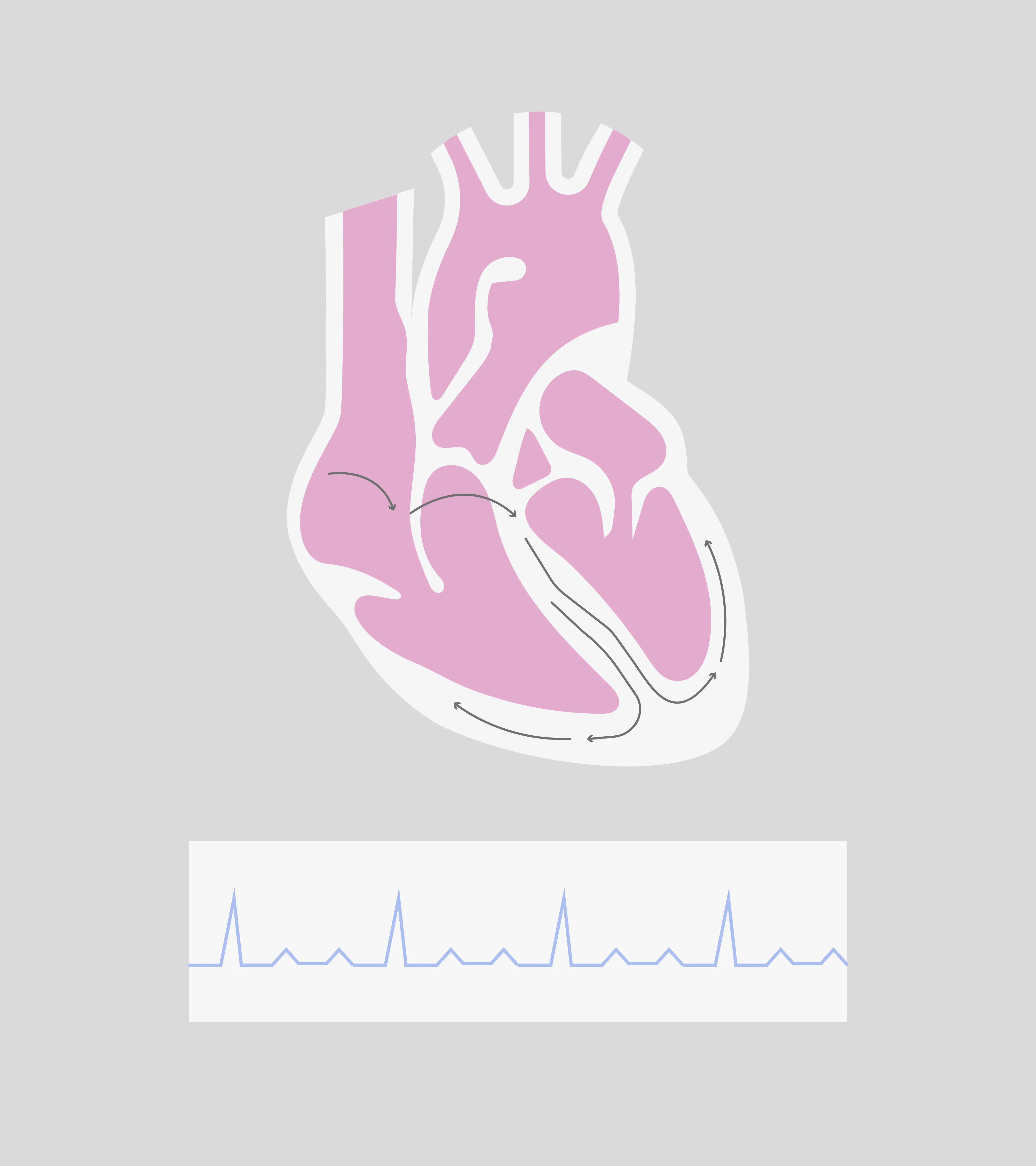 Normal rhythm.