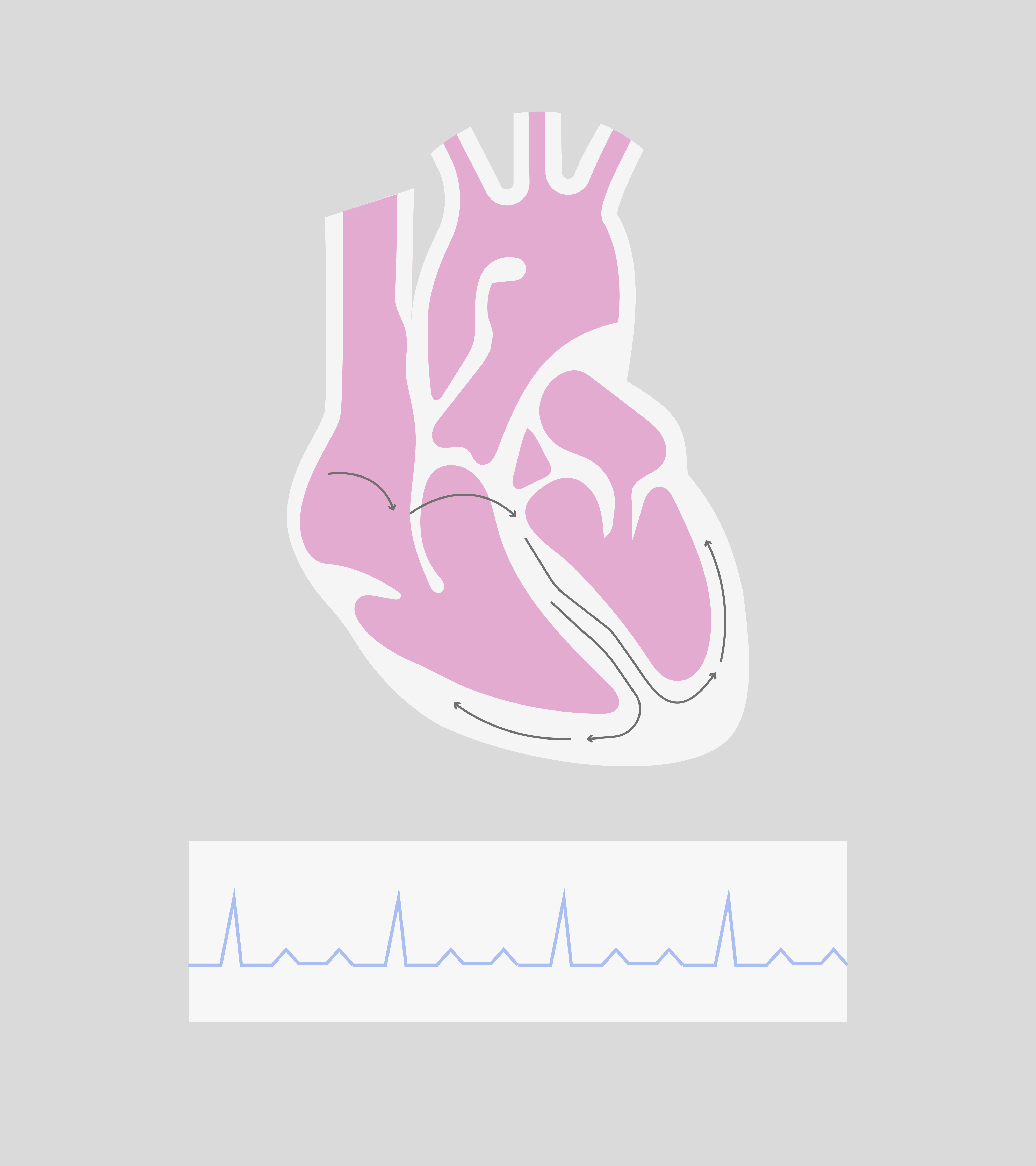 Normal rhythm.