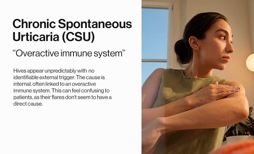 Chronic Spontaneous vs. Inducible Urticaria: What Is the Difference? *Patient Portrayal